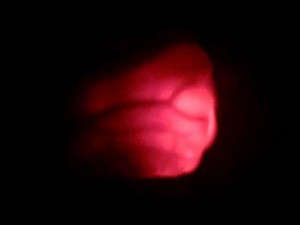 NeoGlo in use on adult hand