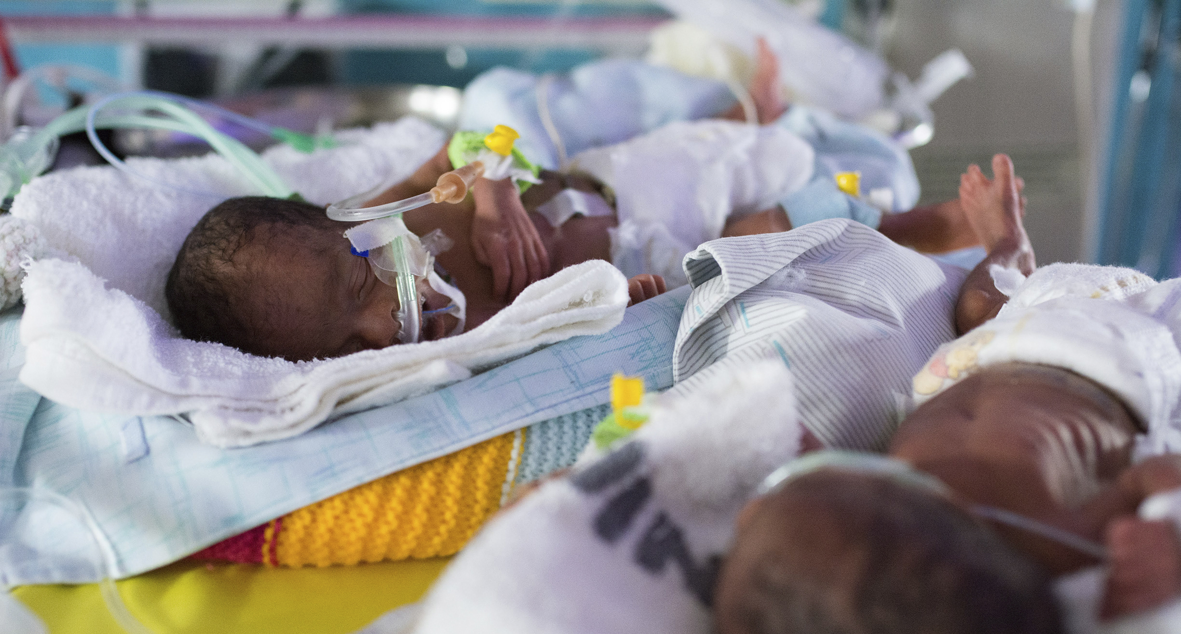 Two babies from Uganda with RAM