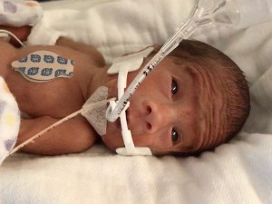 Nathan with a NeoBar in the NICU