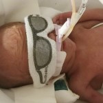 NeoBar providing neonatal ET tube support