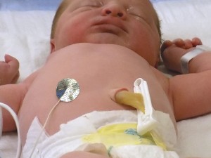 N7321 NeoSmile Hydrogel temp probe cover in-use on baby